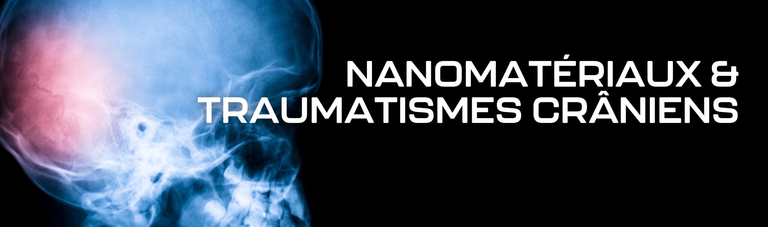 Nanomatériaux théranostiques et traumatismes crâniens
